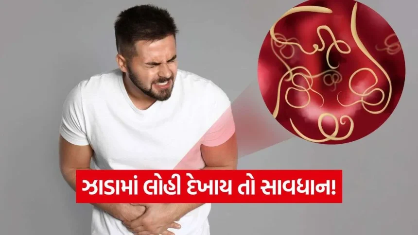ગેસ કે એસિડિટી સમજીને અવગણતા નહીં! પેટની આ તકલીફો હોઈ શકે છે કેન્સરના સંકેત 1 iNDIA 2026 10 22T072142.006.jpg.webp