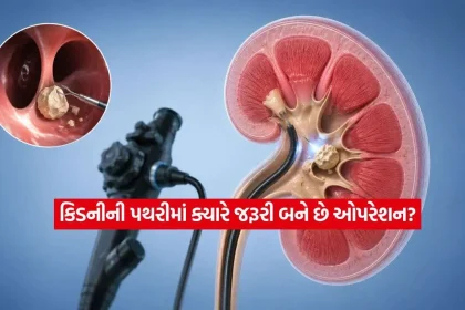 kidney1.jpg.webp